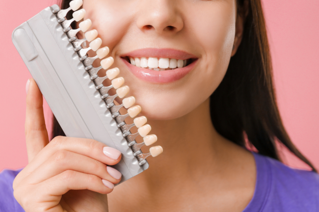 Carillas dentales, consigue la sonrisa perfecta