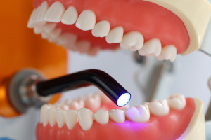 Estética dental, qué es y por qué se realiza