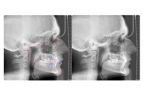 radiografia dental zaragoza