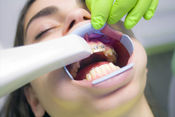 ortodoncia dental niños