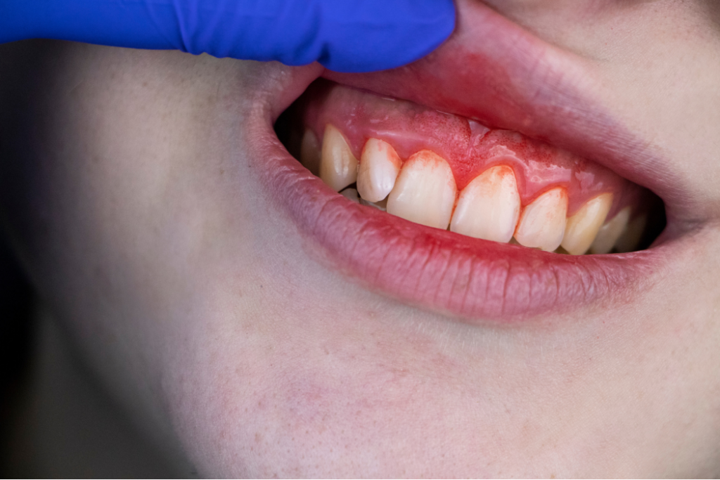 Consejos para que el niño pierda el miedo a ir al dentista