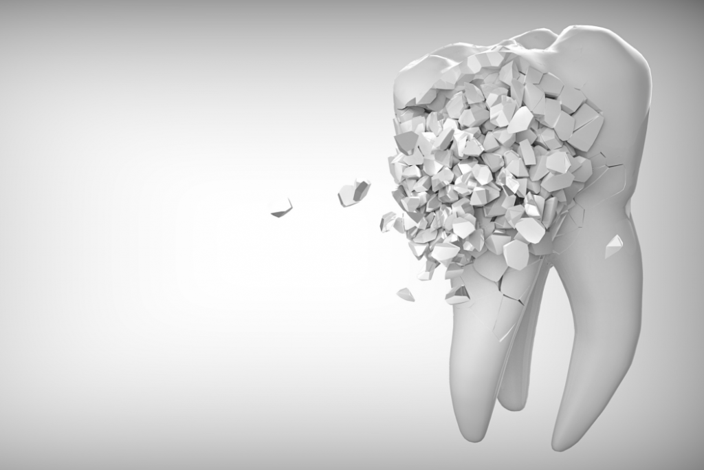Qué es la erosión dental