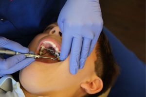 ¿Cuáles son los diferentes tipos de tratamiento de ortodoncia infantil disponibles?