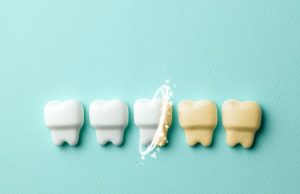¿Qué componentes tiene el blanqueamiento dental?