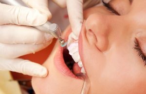 ¿Qué es una reconstrucción estética dental?