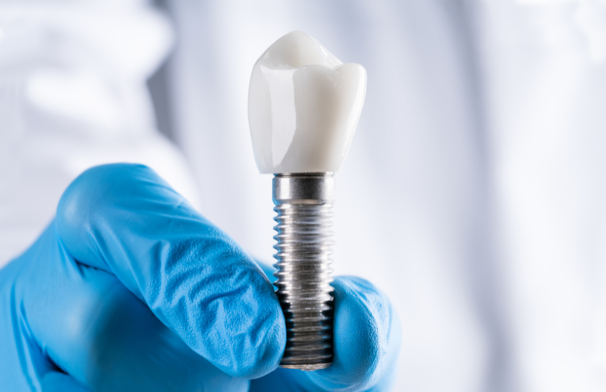Colocación de Implante Dental ¿Qué fases tiene el proceso