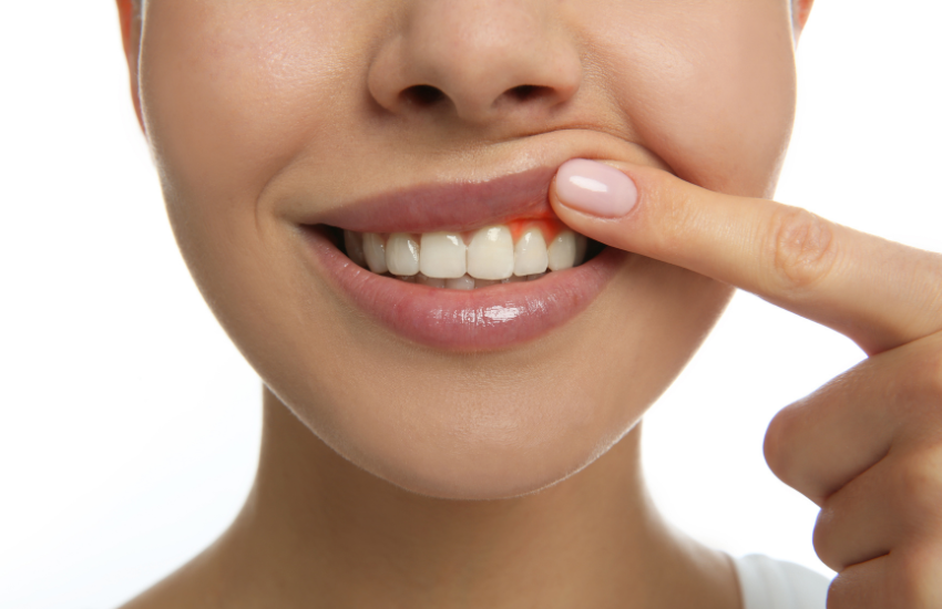 Síntomas de la infección dental ¿Cuándo se necesita una endodoncia