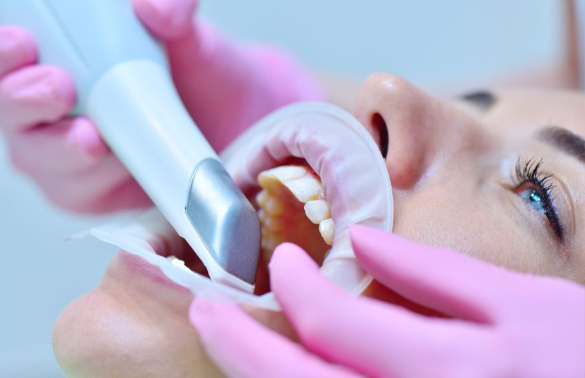 ¿Conoces el escáner intraoral