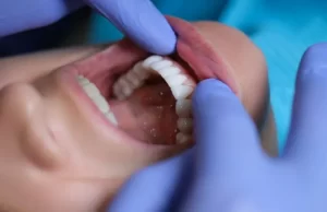 boca de una mujer en el dentista cuidando su salud periodontal