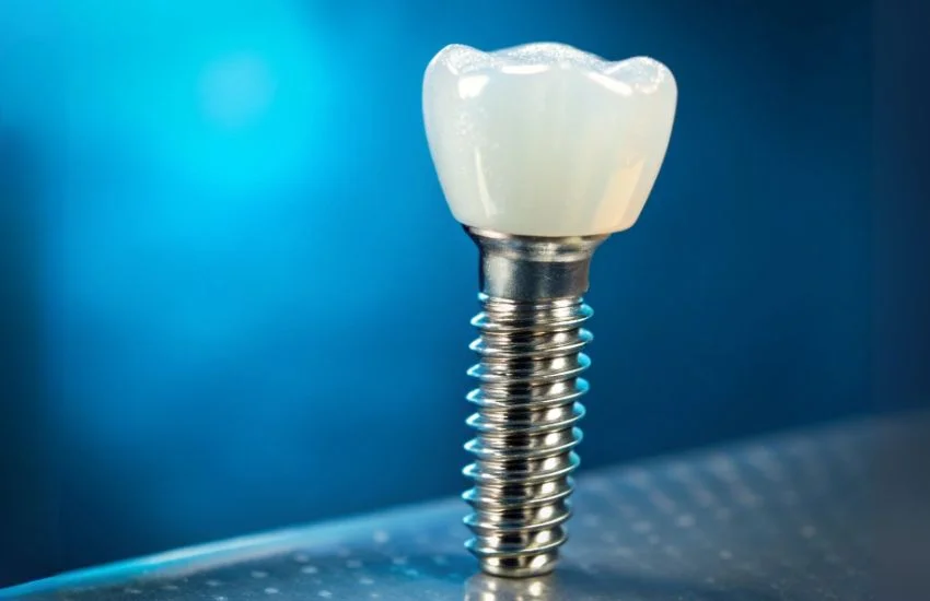 Implante de carga inmediata con corona dental para rehabilitación estética en zona anterior