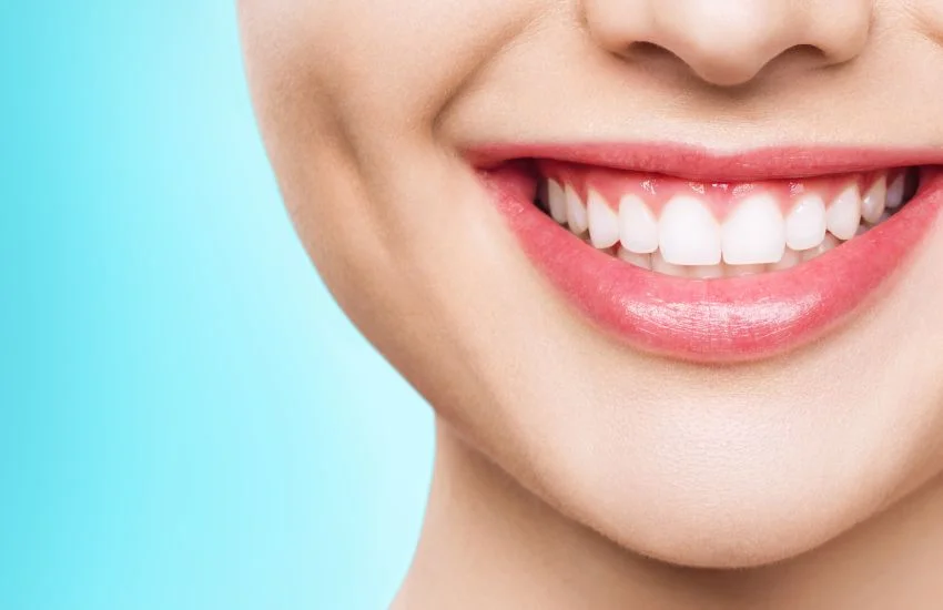 Mujer joven sonriendo con dientes blancos y encías saludables, ejemplo de resultado estético con implantes de carga inmediata en zona anterior