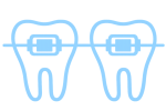 Brackets de autoligado azul